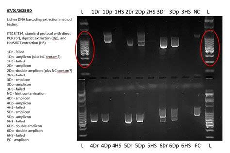 how to read a gel electrophoresis|How to Interpret DNA Gel Electrophoresis Results .